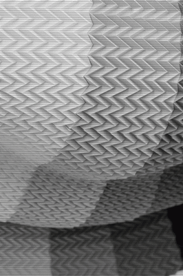 Undulation