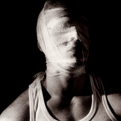 Broken Hands