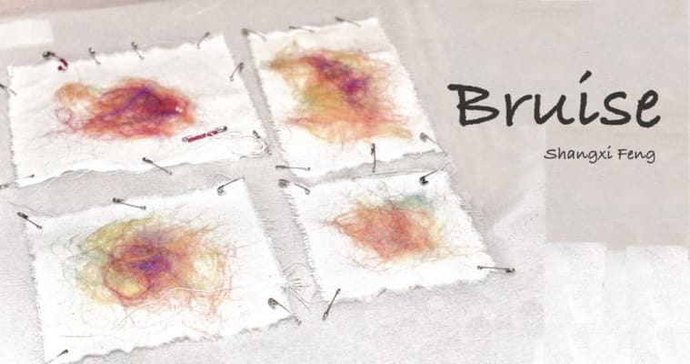 Bruise