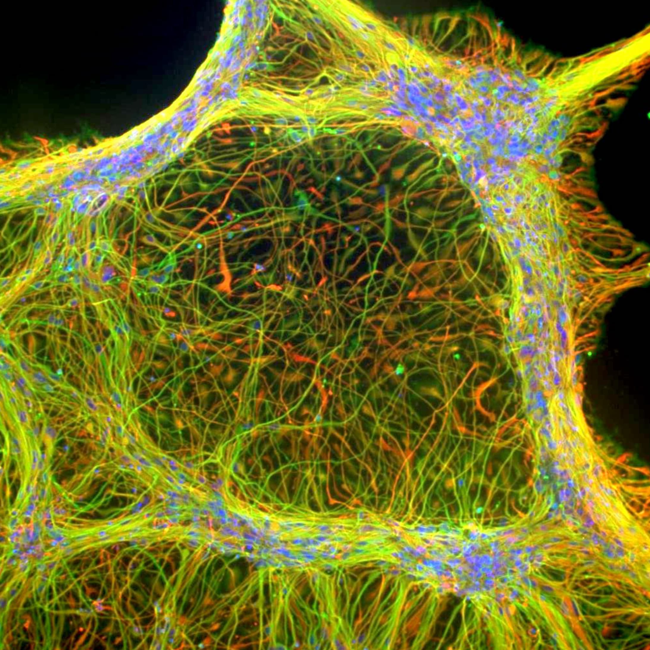 Alice_Taylor_hNSCs_diamond.png