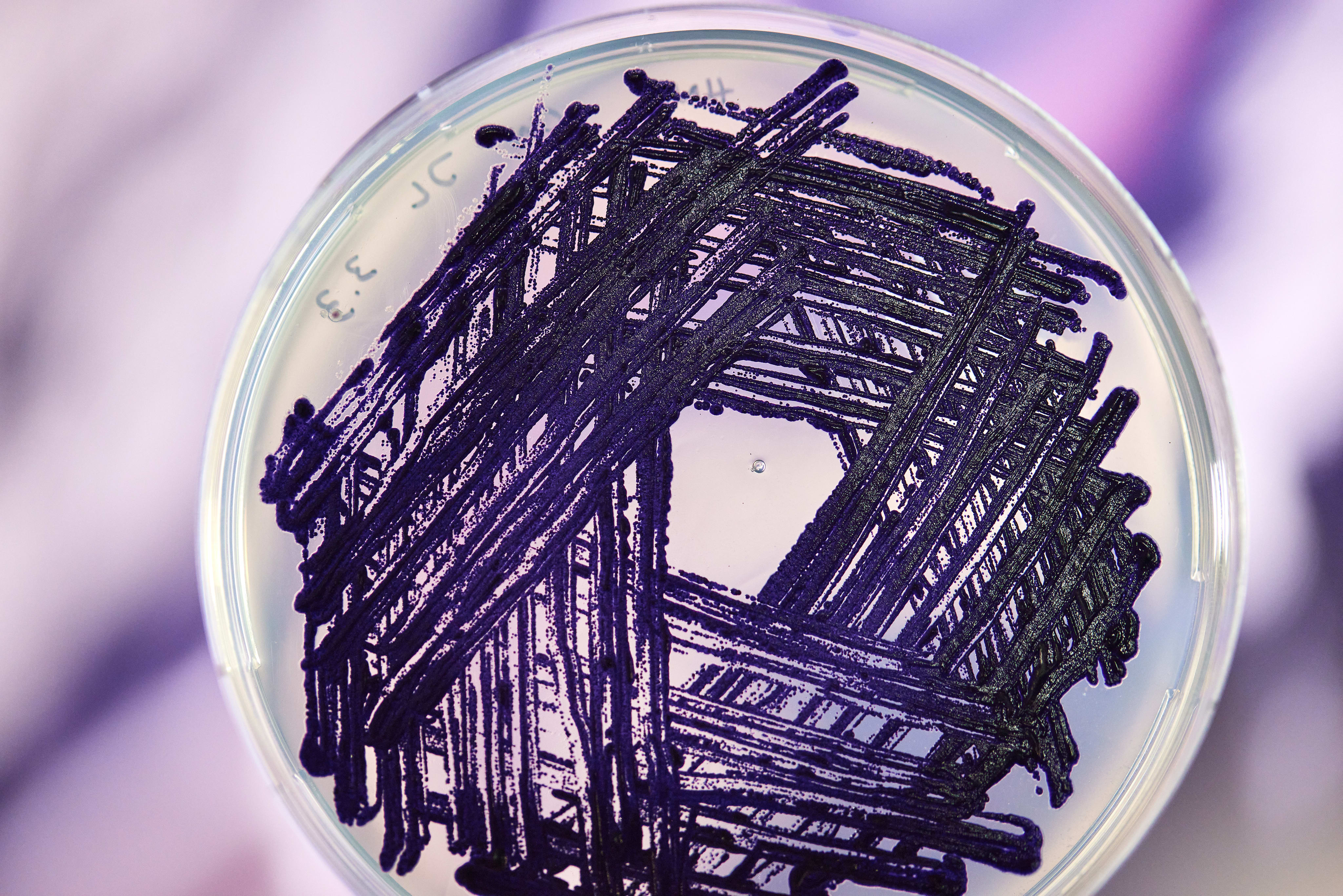 Close-up-of-bacteria-Janthinobacterium-lividum,-photography-paul-cochrane-for-maison-0.jpg