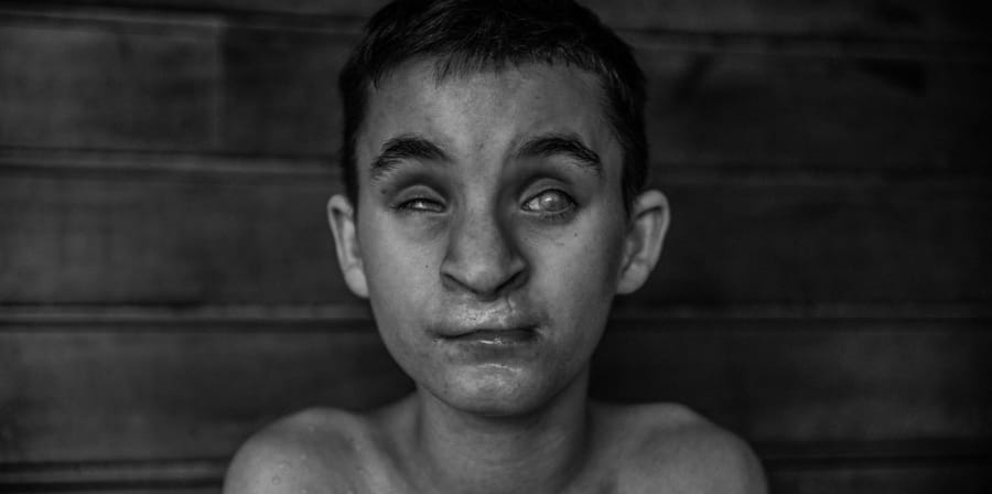 blind child from monastery in poland