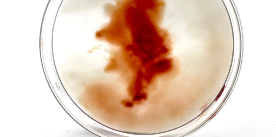 A petri dish with an amorphous red form inside 