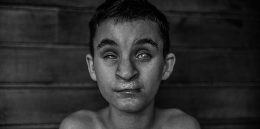 blind child from monastery in poland