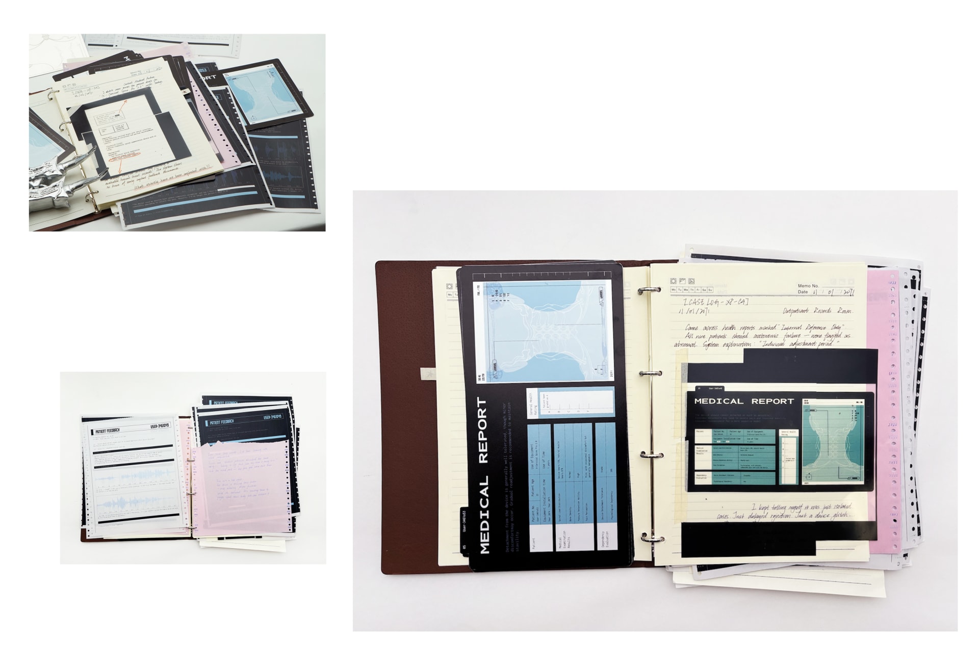 A medical binder with layered reports, notes, and X-ray-like images—evidence from a speculative enhancement investigation.