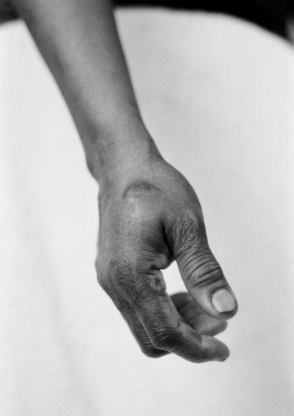 Black and white photograph of a person's hand, the thumb is facing towards the camera. 