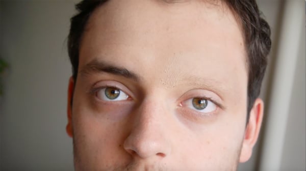 a close-up portrait of a person with one eyebrow missing