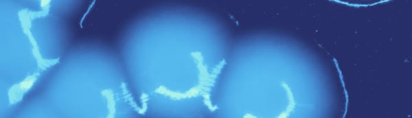 Visual depiction of connecting circular pale blue microbes against a darker blue background