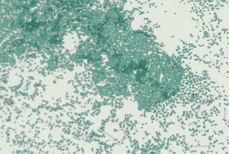 Microscopic image showing the bacterial spores in green while there are a few bacterial cells stained in pink