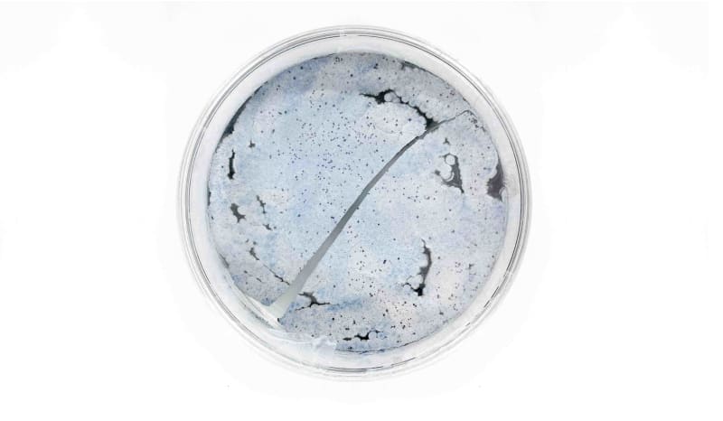 Petri dish with bacteria growth.