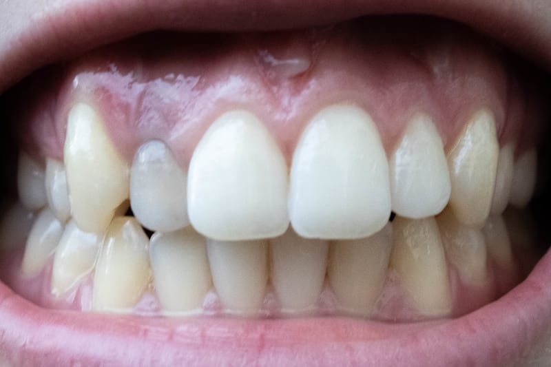 Extreme close up of a set of teeth