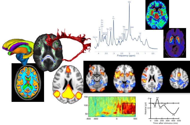 An image comprised of many different brain scans and graphs