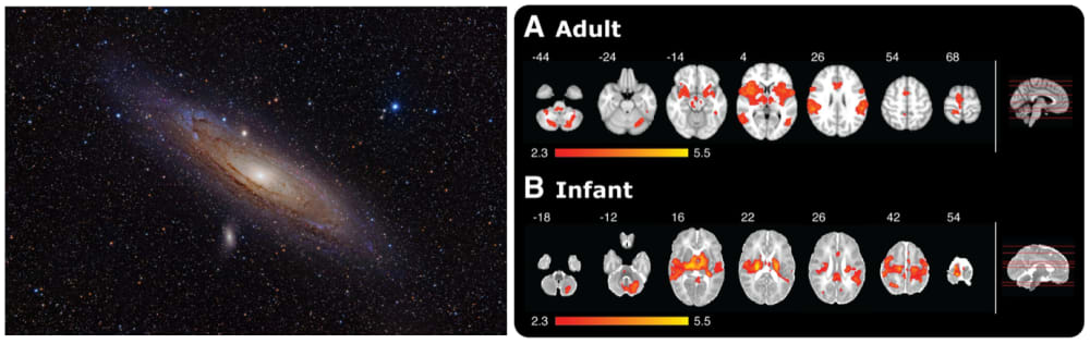 The Andromeda Galaxy (left) contains about the same number of stars as the human brain contains neurons (right).