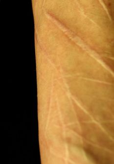 cuts to skin