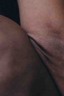 skin close up