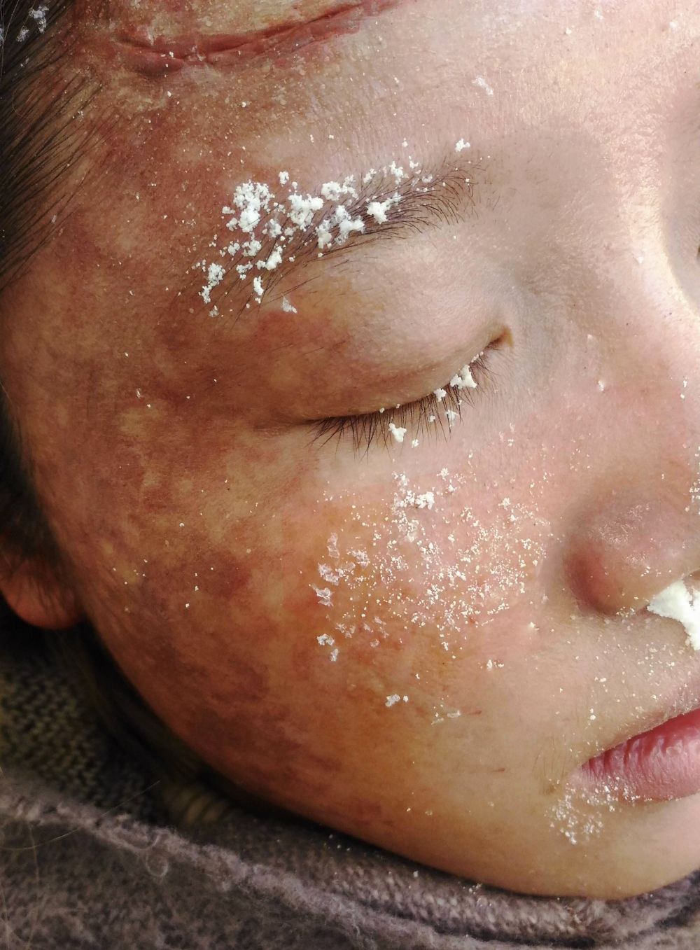 Student work by Livia Toso, Special Effects frostbite makeup