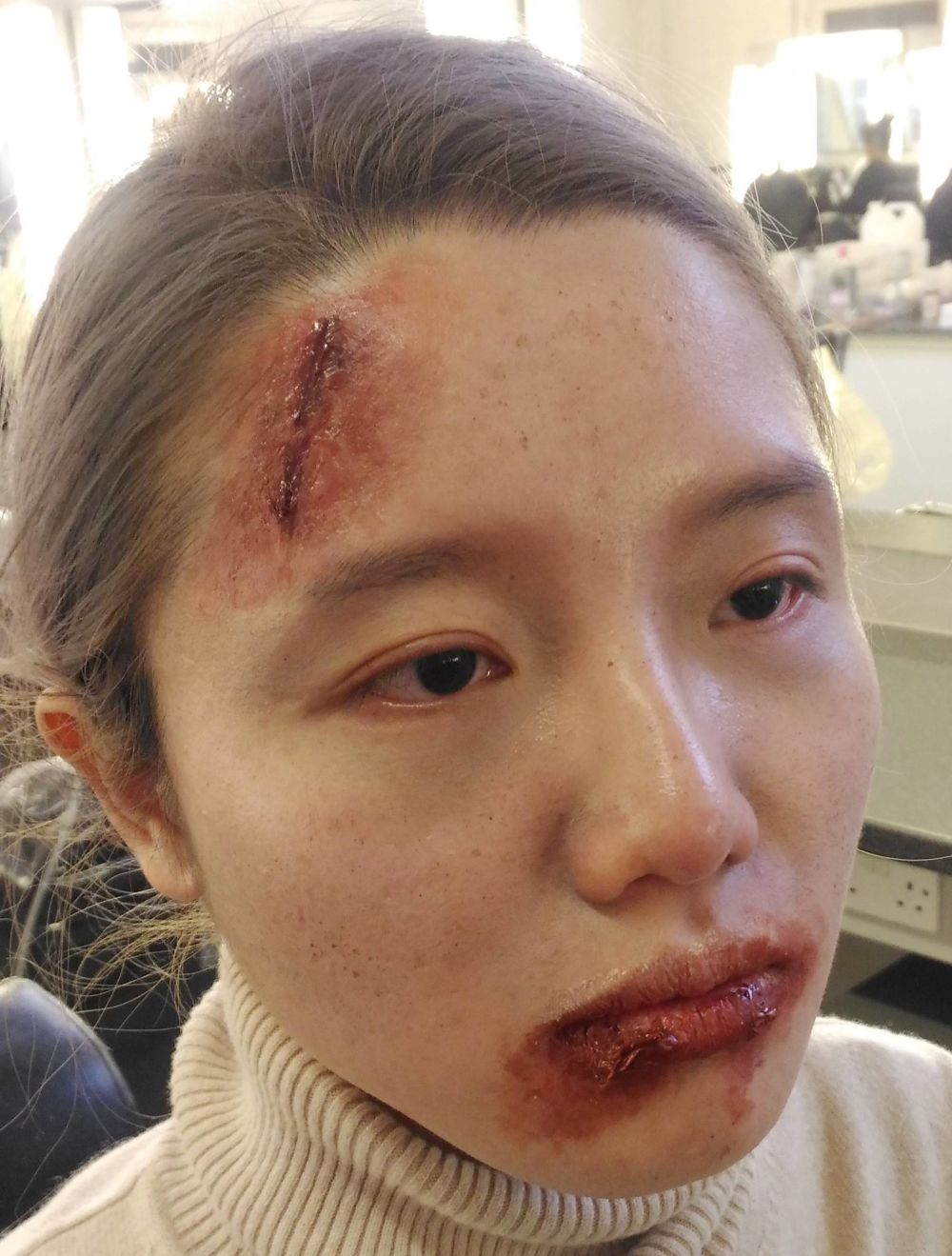 Livia Toso Student Work - Cuts and Bruises
