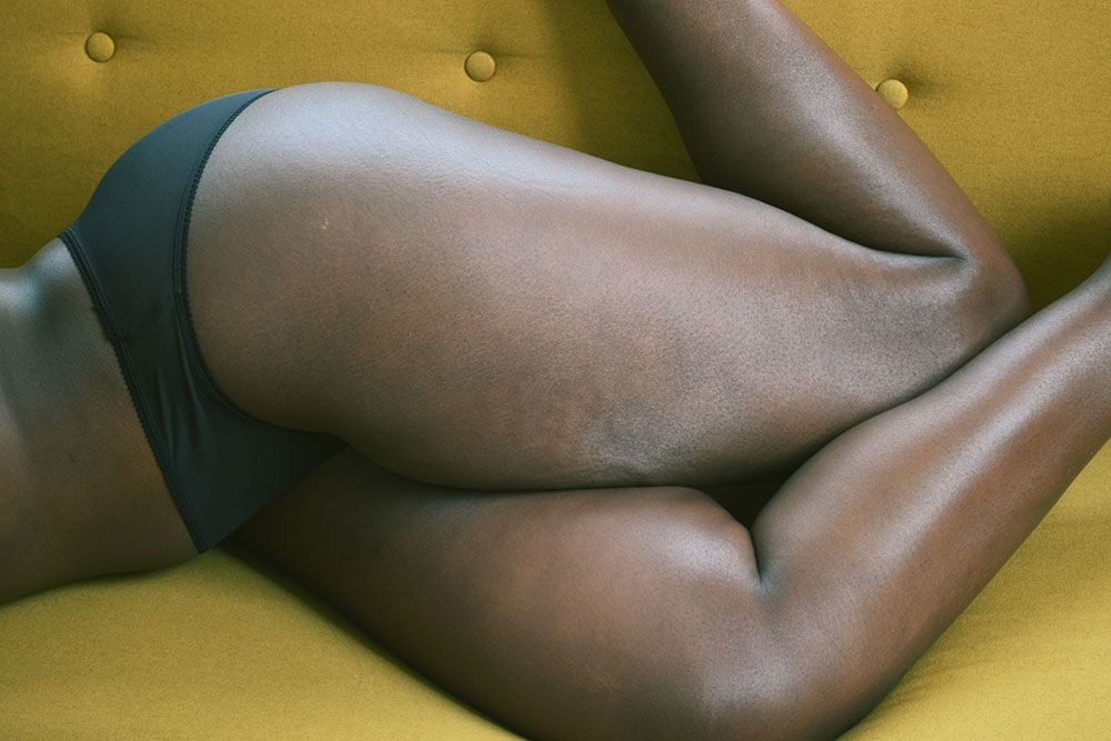 Photograph of black female model's legs lying on a yellow sofa